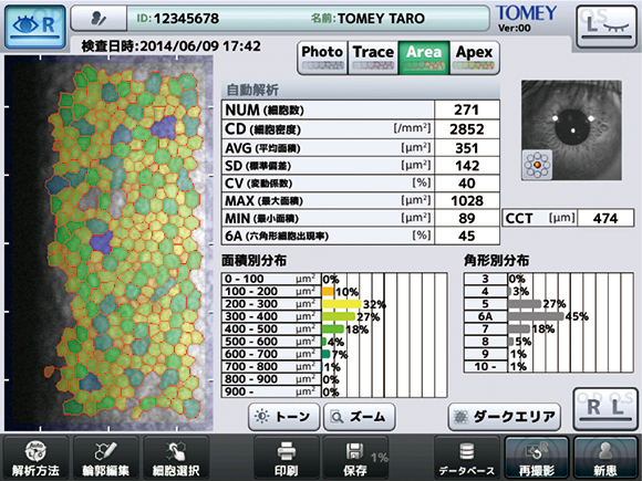 角膜内皮細胞検査（スペキュラマイクロスコープ）EM4000