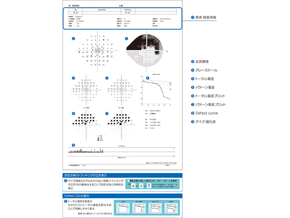 視野検査・imo